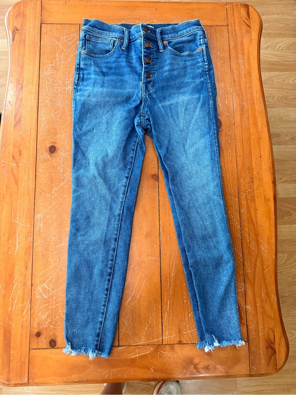 Madewell Button-Fly Skinny Jeans in Medium Blue Wash
